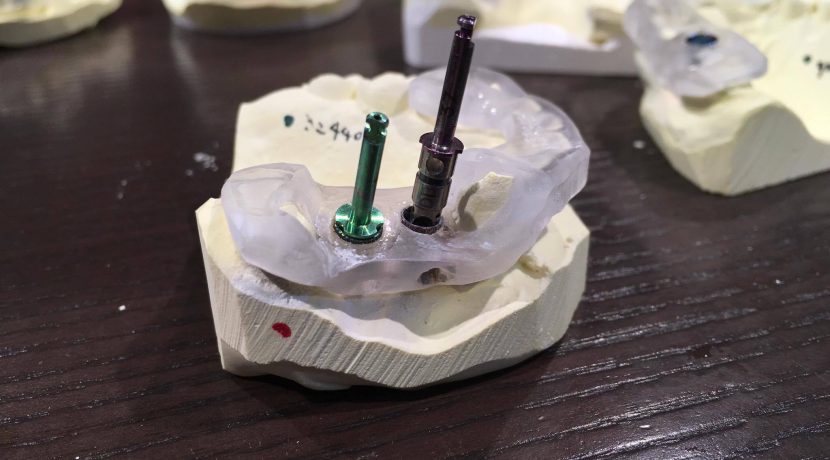 サージカルガイドのシミュレーション時に留意すべき項目｜インプラント