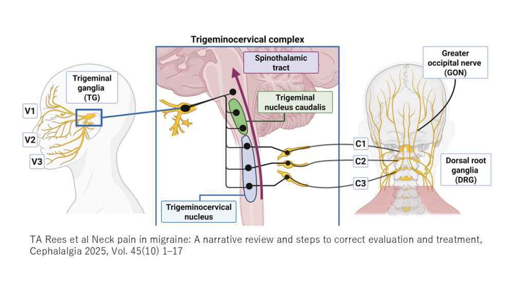 片頭痛｜だいだいクリニック 九段下頭痛外来｜脳神経外科