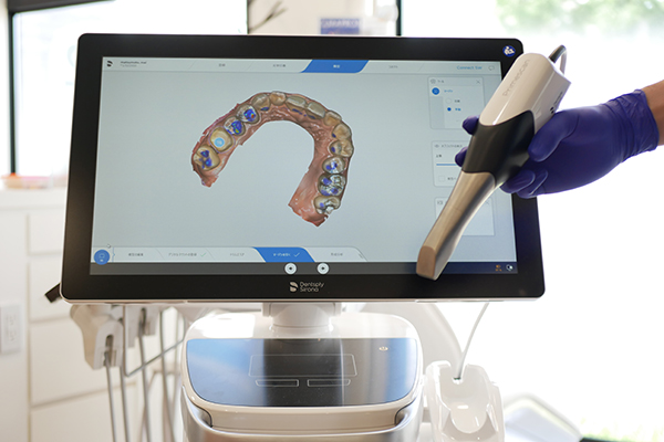 口腔内スキャナー(型取りがいらない治療)｜福岡市西区の歯科・歯医者