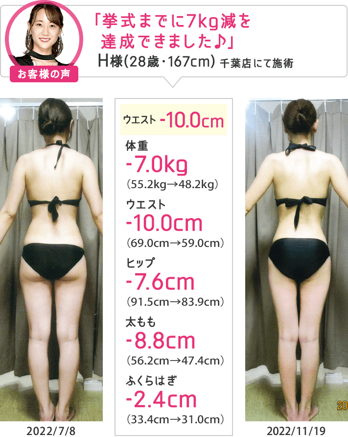 痩身エステなら目指せ！合計-8cmやせる体験｜エステのエルセーヌ