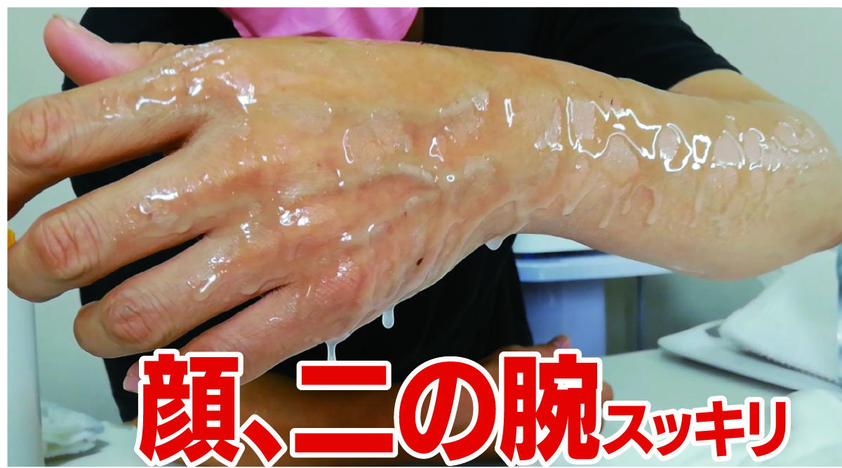 ゼロジーフリー - ECGエステコスメグループ