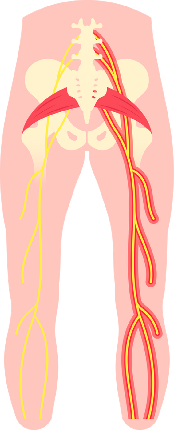 腰椎椎間板ヘルニアの症状と治療方法について整形外科医が解説：ふな