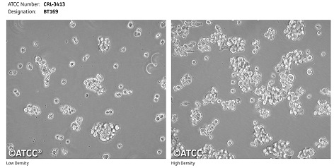 ATCC®の神経細胞株 | ATCC® Neural Cell Lines | フナコシ