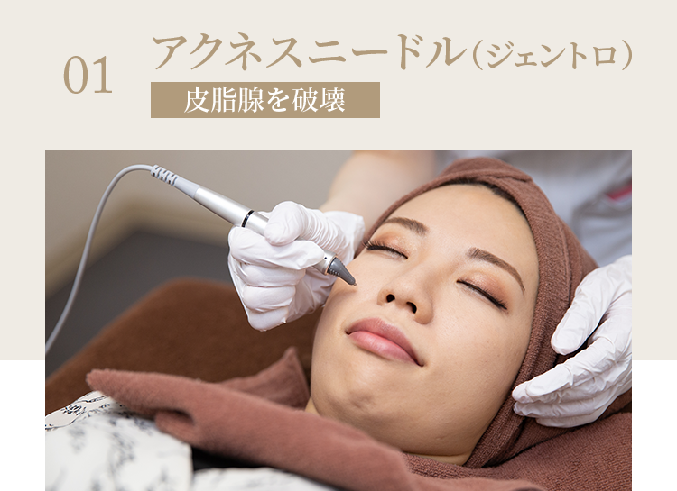 繰り返さないニキビ治療｜東京の美容皮膚科・美容外科のKM新宿クリニック