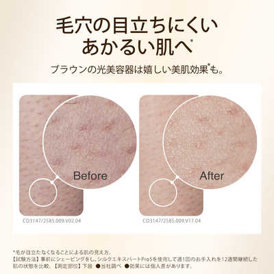 ブラウン BRAUN 家庭用脱毛器 光美容器「シルクエキスパートPro5」(IPL