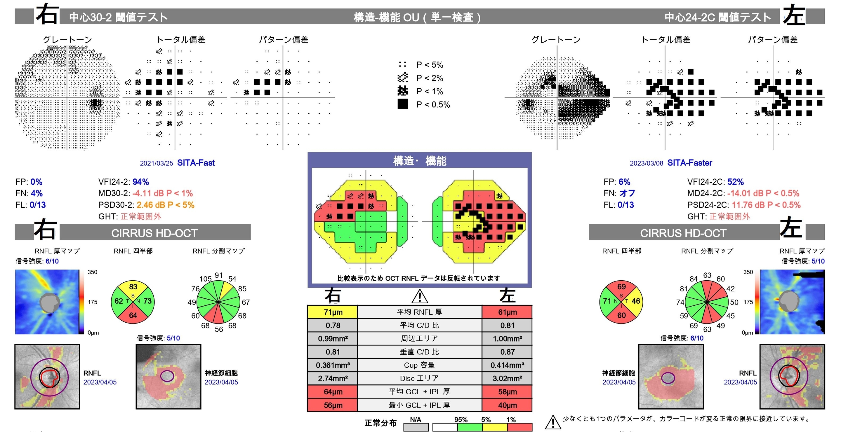 緑内障|怖い目の病気、緑内障の検査と治療は梶川眼科院へ