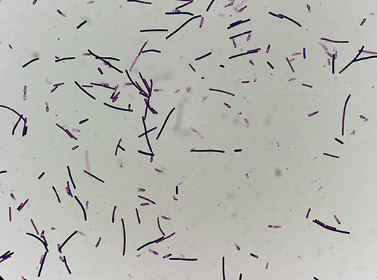 microbiology round - 亀田総合病院 感染症内科