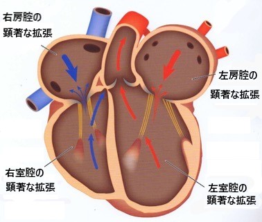 猫の心筋症｜京都市左京区の動物病院「かもがわ動物医療センター」