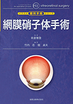 イラスト眼科手術シリーズ6 網膜硝子体手術 | 金原出版