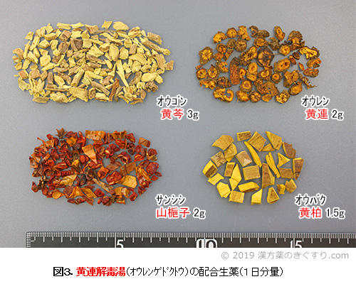 脳梗塞と脳出血の漢方（1）後遺症 | 病気の悩みを漢方で | 漢方を知る