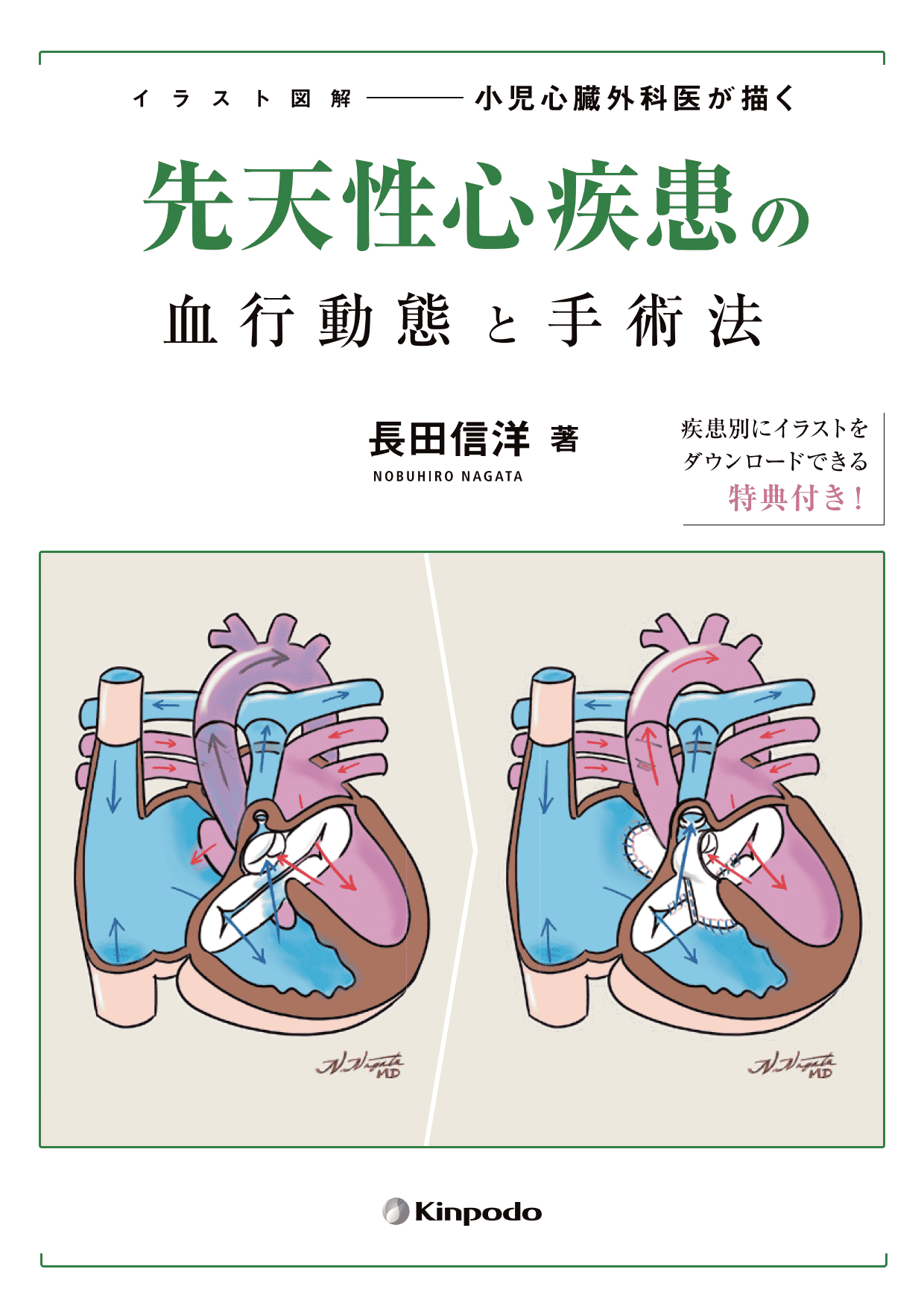 イラスト図解 小児心臓外科医が描く先天性心疾患の血行動態と手術法