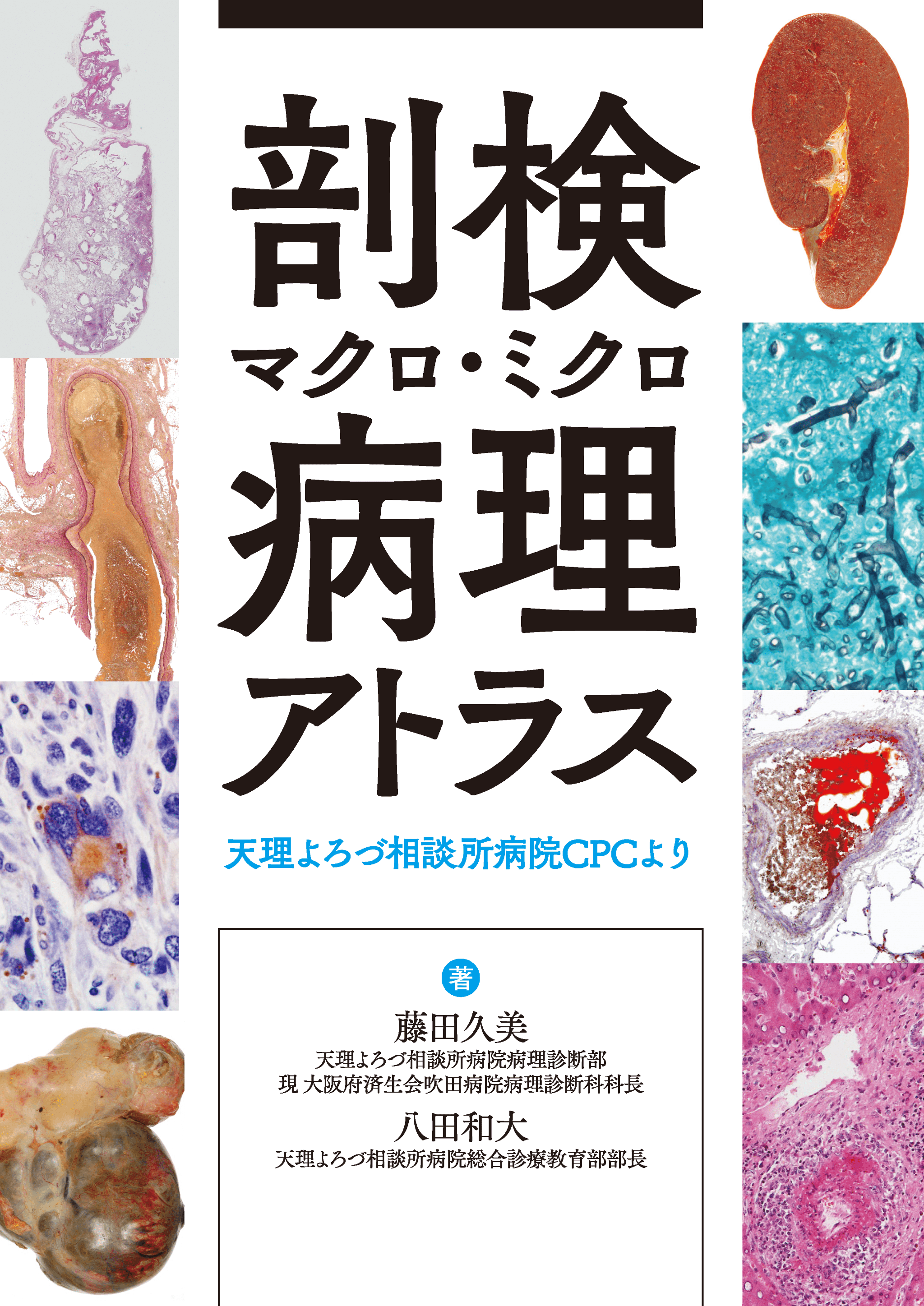剖検マクロ・ミクロ病理アトラス 天理よろづ相談所病院CPCより - 株式