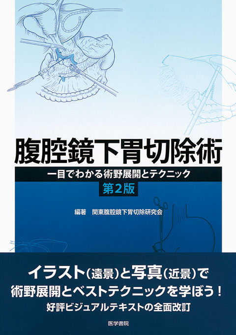腹腔鏡下胃切除術 第2版 | 書籍詳細 | 書籍 | 医学書院