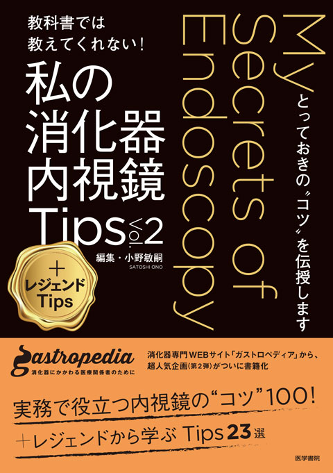 私の消化器内視鏡Tips Vol.2 ＋レジェンドTips | 書籍詳細 | 書籍