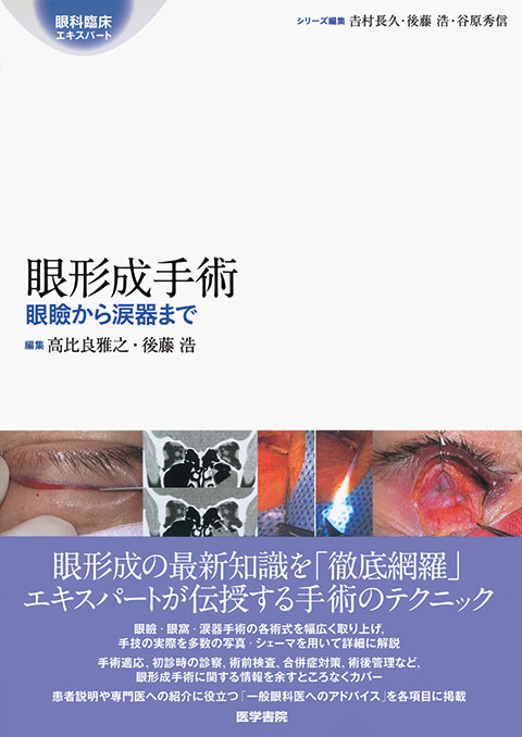知っておきたい眼腫瘍診療 | 書籍詳細 | 書籍 | 医学書院