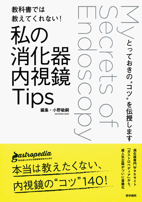 私の消化器内視鏡Tips Vol.2 ＋レジェンドTips | 書籍詳細 | 書籍
