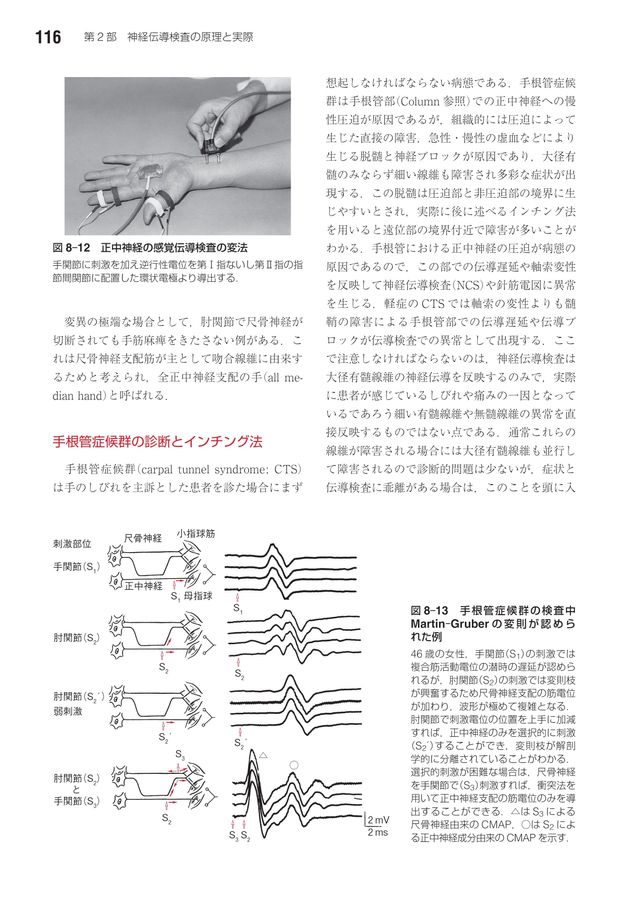 神経伝導検査と筋電図を学ぶ人のために_第2版_立読み