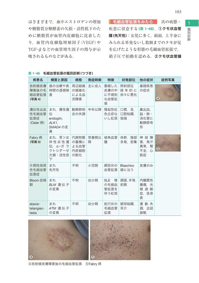 今日の皮膚疾患治療指針_第5版_立読み