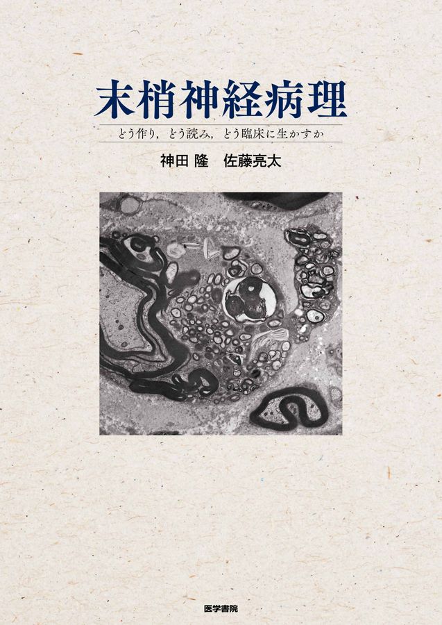 末梢神経病理_立読み