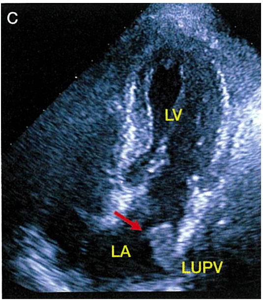 心臓超音波テキスト 第3版 正誤表／補足情報／医歯薬出版株式会社