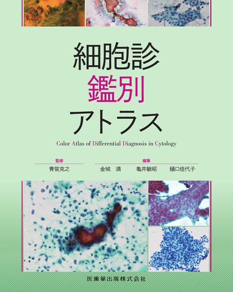 解明 病理学 病気のメカニズムを解く／医歯薬出版株式会社