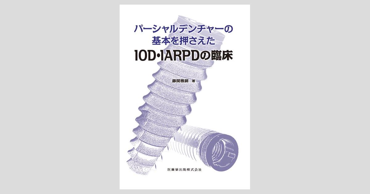パーシャルデンチャーの基本を押さえたIOD・IARPDの臨床／医歯薬出版