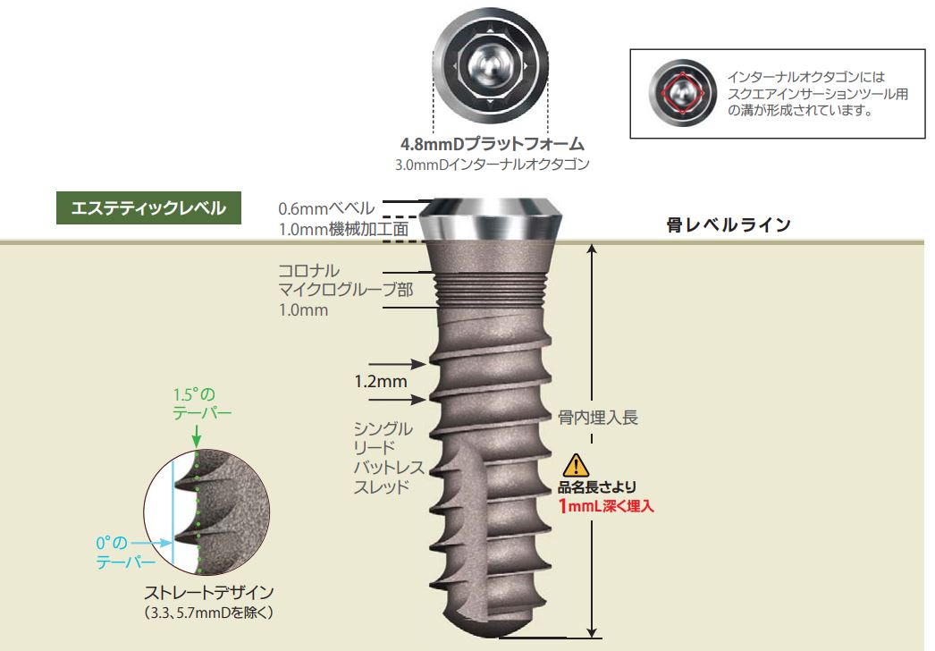 スウィッシュプラスシステム|株式会社インプラテックス