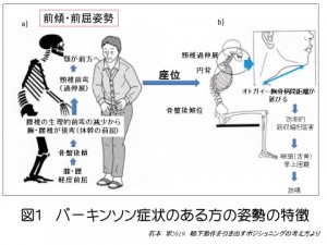 摂食姿勢の工夫 ～パーキンソン病およびパーキンソン症候群～(2020/06
