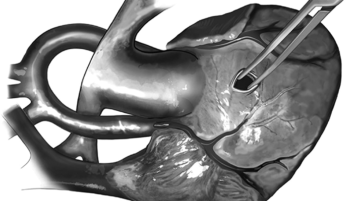 Home Page: Operative Techniques in Thoracic and Cardiovascular Surgery