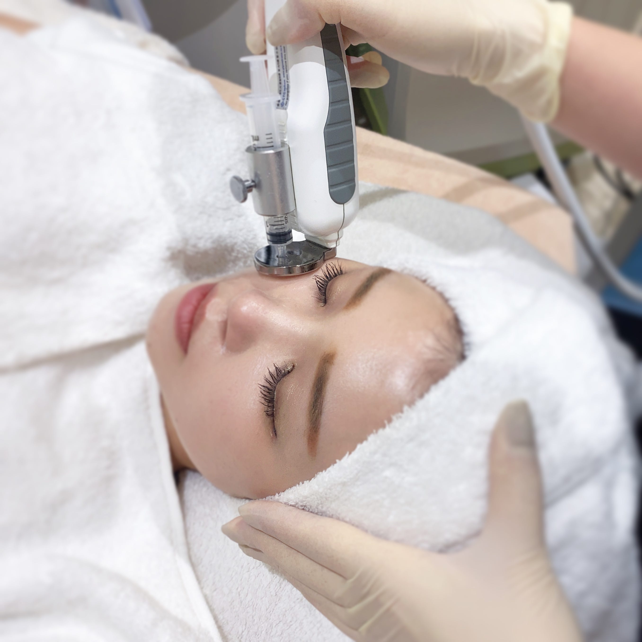 毛穴の汚れをオフ 美肌に導く 超音波洗浄＋エレクトロポレーション導入