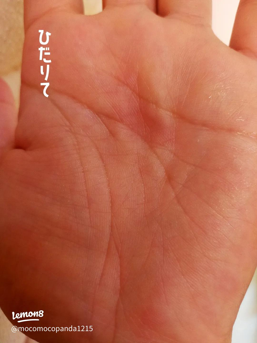 手相と癌検診の重要性について