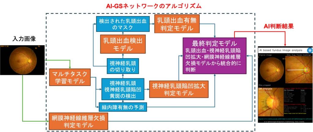 眼科専門医レベルの緑内障診断AIの開発に成功 医療過疎地や大規模眼底