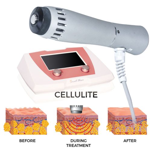 Dermatological Equipments - LUMSAIL INDUSTRIAL INC.