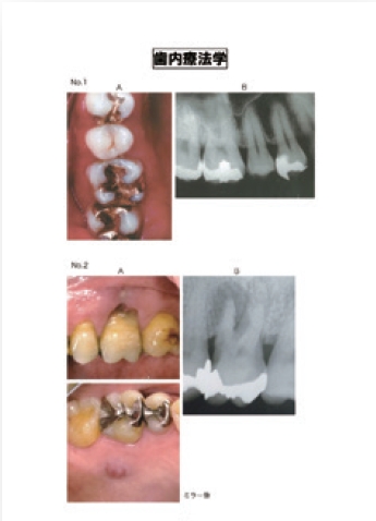 豊富な教材｜DES 歯学教育スクール