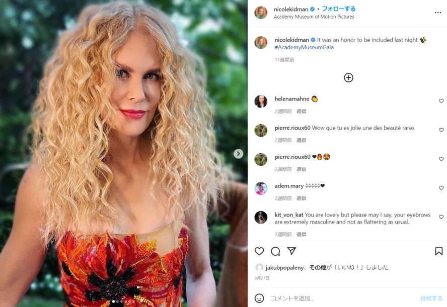 ニコール・キッドマン、美しい白肌の秘訣は？ 過去のボトックスは後悔