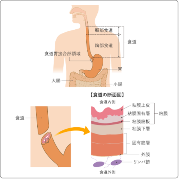 患者さんへ：診療内容（診療グループ）胃・食道外科｜長崎大学大学院