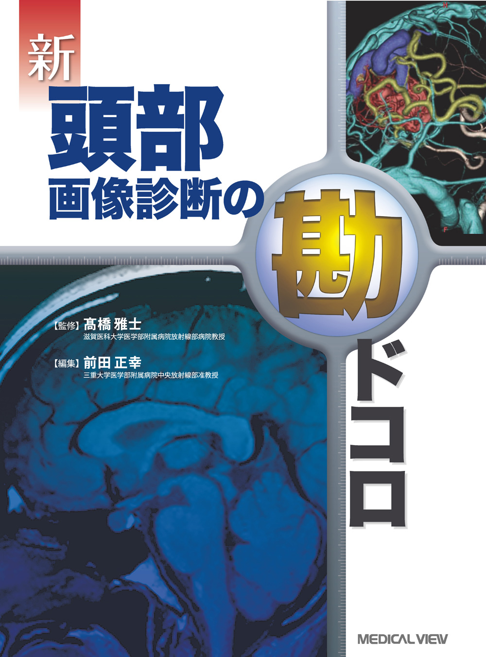 メジカルビュー社｜画像医学・放射線医学｜画像診断の勘ドコロ 新 頭部