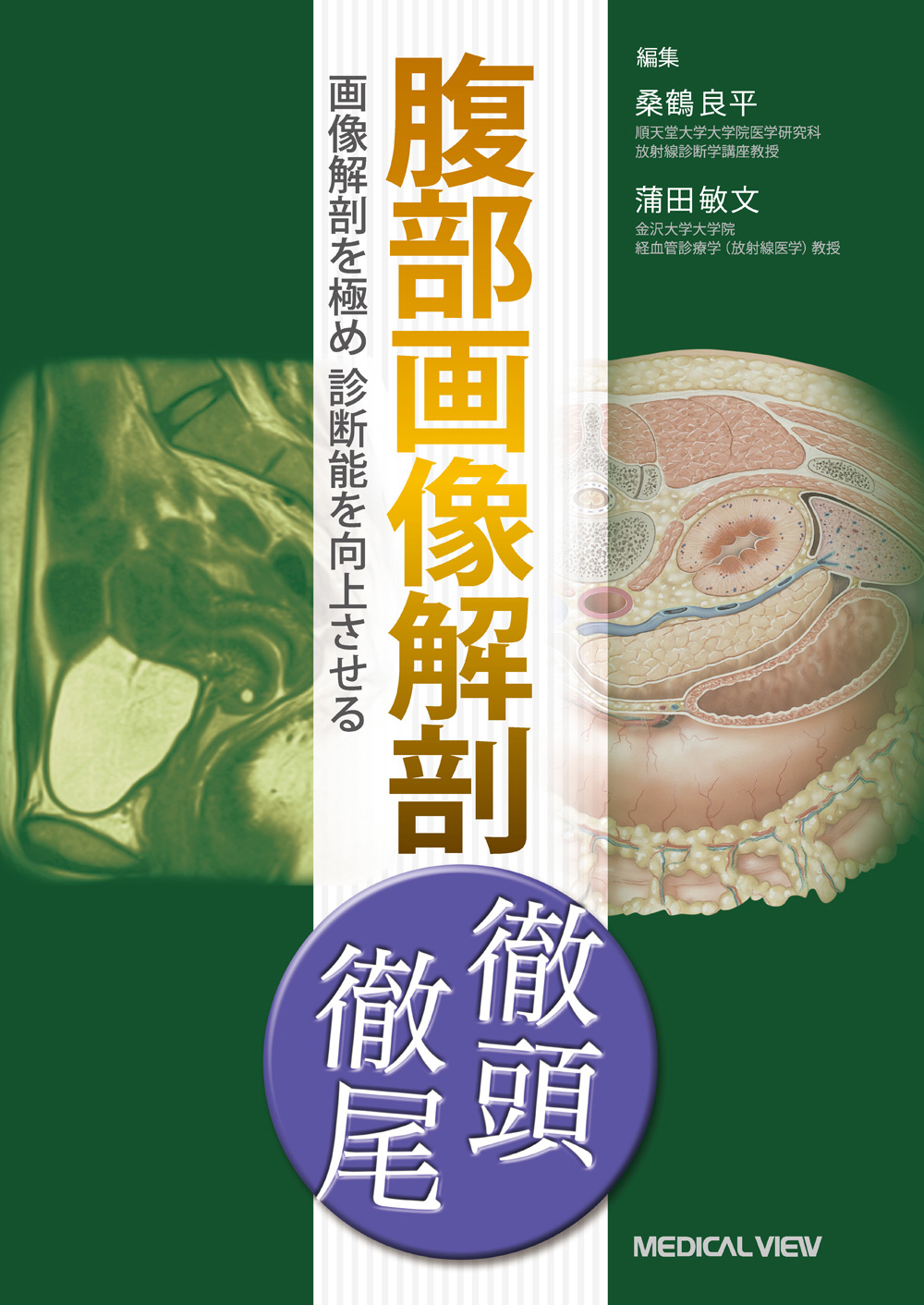 メジカルビュー社｜画像医学・放射線医学｜画像解剖 徹頭徹尾 腹部画像