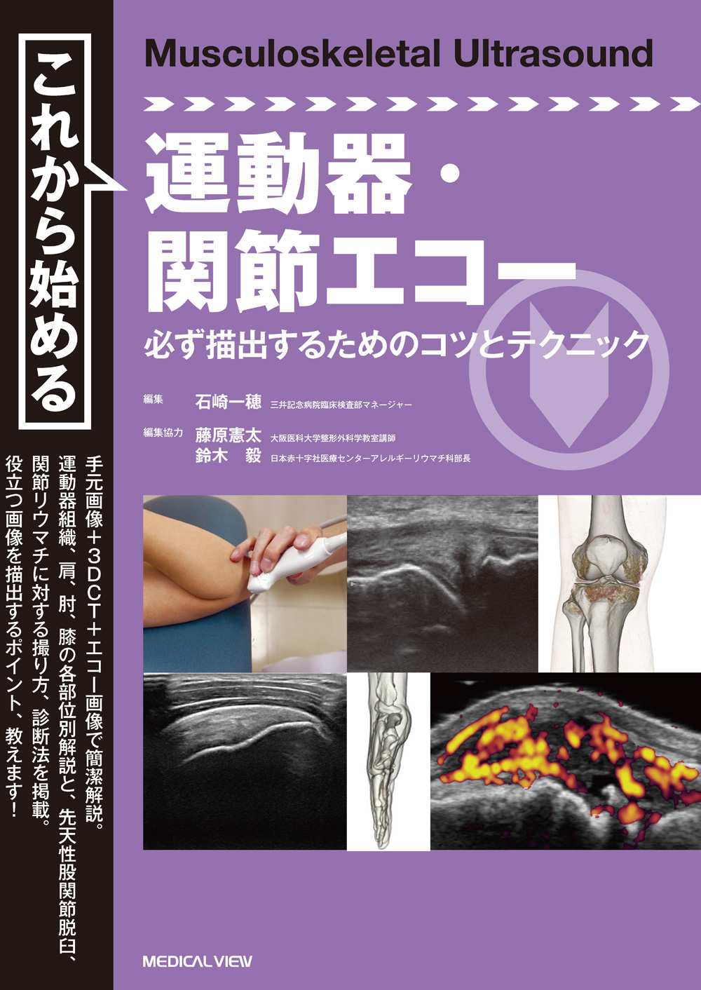 メジカルビュー社｜整形外科｜これから始める運動器・関節エコー