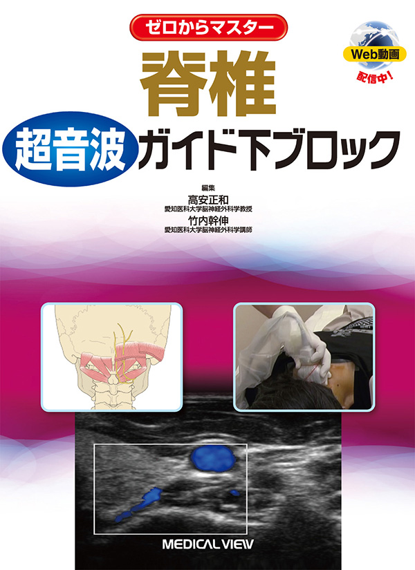 メジカルビュー社｜脳神経外科｜ゼロからマスター 脊椎超音波ガイド下