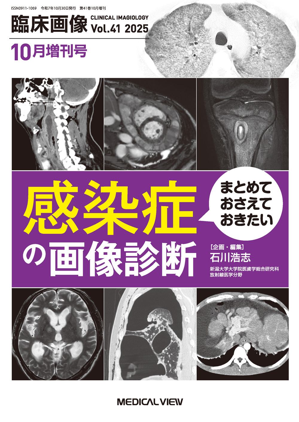 メジカルビュー社｜臨床画像特集一覧｜臨床画像 2025年10月増刊号
