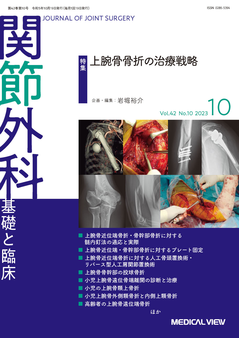 メジカルビュー社｜関節外科特集一覧｜関節外科 2023年10月号