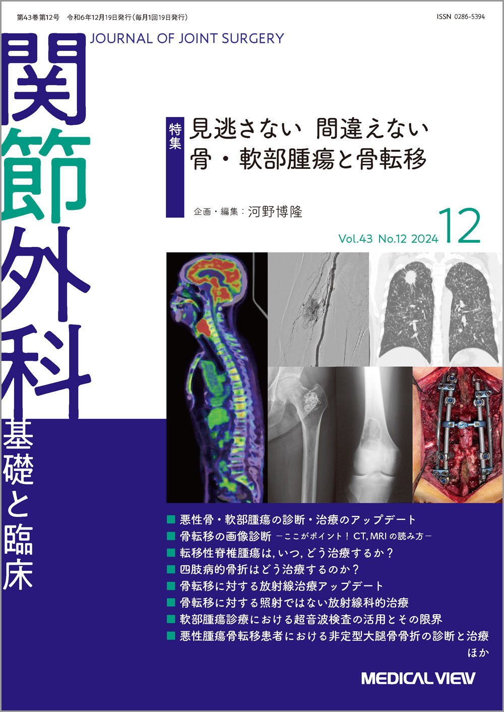 メジカルビュー社｜関節外科特集一覧｜関節外科 2024年12月号