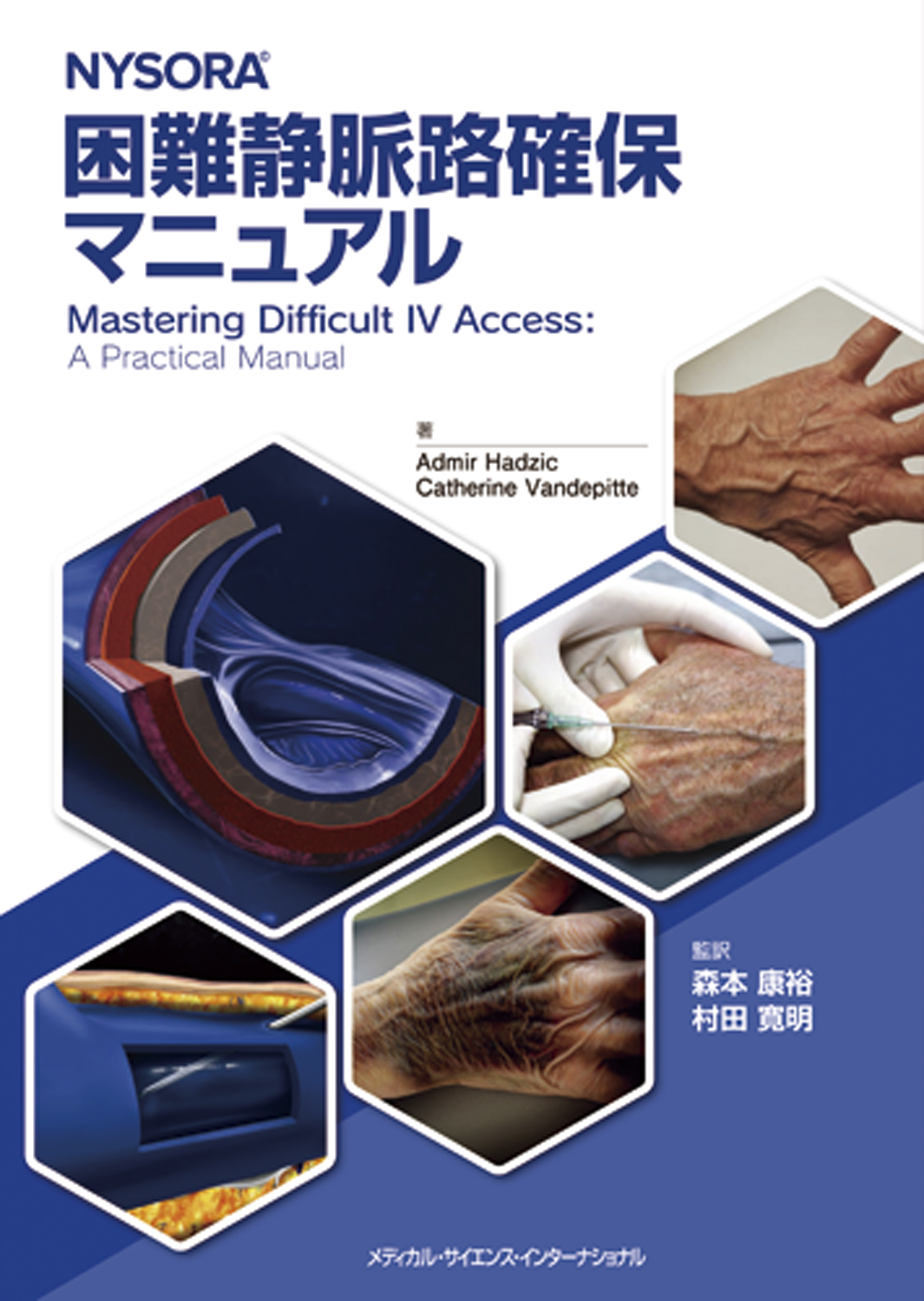 MEDSi)株式会社 メディカル・サイエンス・インターナショナル / NYSORA