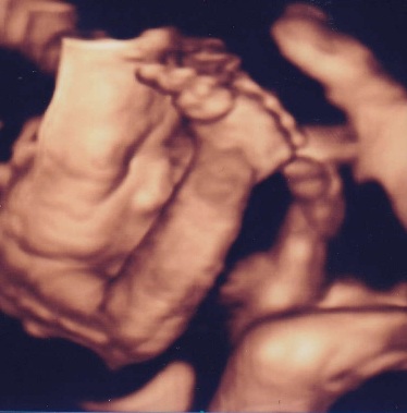 妊娠したかも | みきレディースクリニック - 溝の口駅東口から徒歩3分