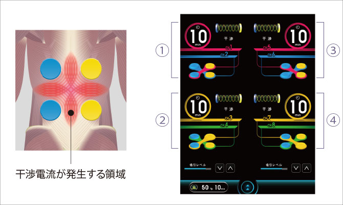 低周波・干渉波組合せ理学療法機器 KT-108+｜ミナト医科学