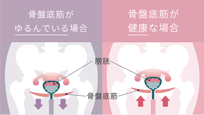 自分では鍛えにくい骨盤底筋を、座って、手軽に鍛える。骨盤底筋専用