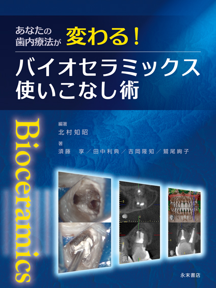 永末書店 あなたの歯内療法が変わる！ バイオセラミックス使いこなし術