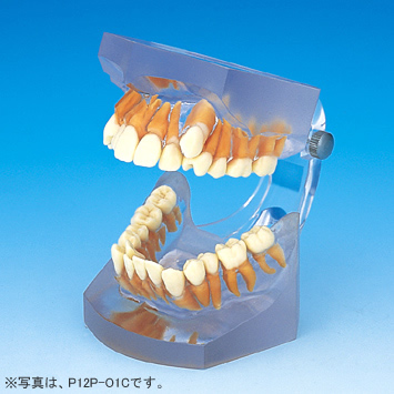 矯正｜株式会社ニッシン｜歯科模型・歯科材料のトップメーカーとして