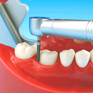 2色レジン製顎模型 [D51-500A-QF](咬合器なし)｜株式会社ニッシン